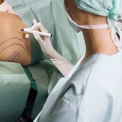 تكلفة جراحة شفط الدهون في الرياض والمملكة العربية السعودية