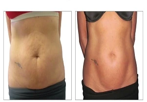 فينوس ليجاسي في الرياض