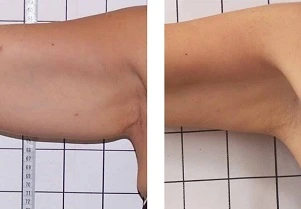 فينوس ليجاسي في الرياض