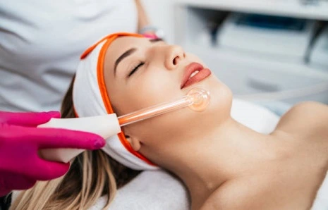 التقشير الكيميائي في الرياض