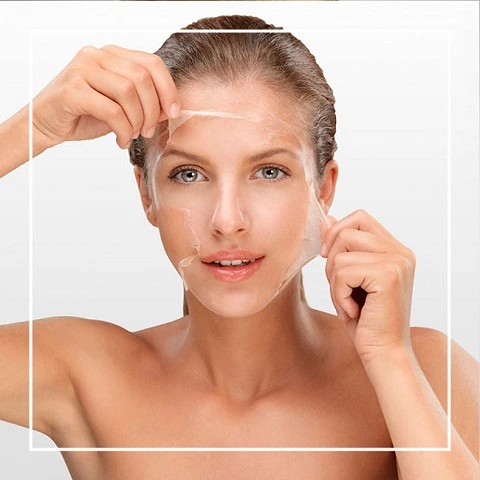 التقشير الكيميائي في الرياض