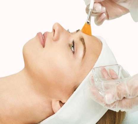 التقشير الكيميائي في الرياض