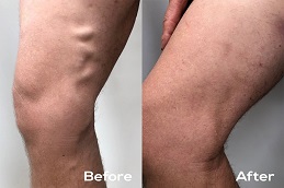 أفضل جراحات الأوعية الدموية في الرياض