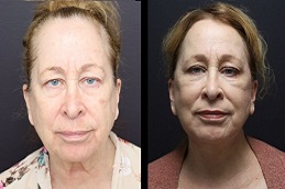 أفضل جراحات التجميل في الرياض