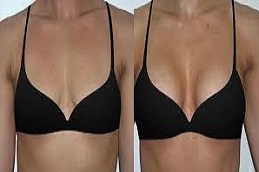 أفضل جراحات الثدي في الرياض