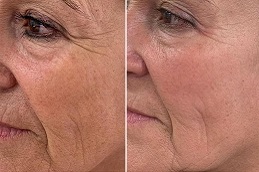 أفضل جراحة تحسين البشرة في الرياض