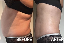 أفضل جراحة تنشيط العضلات الديناميكي (DMA) في الرياض