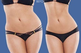 أفضل جراحة حقن ساكسيندا في الرياض