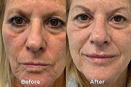 أفضل جراحة شد الجلد وتحديده في الرياض