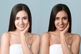 أفضل جراحة لإزالة السمرة في الرياض