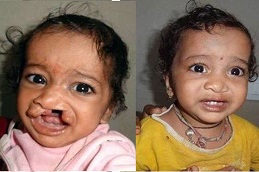 أفضل مراكز التشوهات الخلقية في الرياض