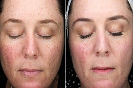 إنلايتن بيكو جينيسيس في الرياض والمملكة العربية السعودية