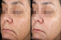 إنلايتن بيكو جينيسيس في الرياض