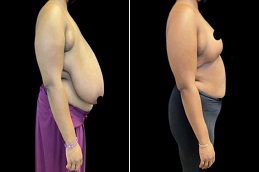 تصغير الهالة في الرياض والمملكة العربية السعودية