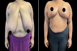 تصغير الهالة في الرياض