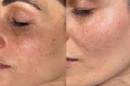 تقشير اليقطين العضوي في الرياض والمملكة العربية السعودية