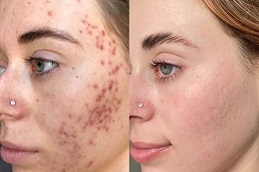 تقشير اليقطين العضوي في الرياض