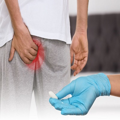 تكلفة علاج البواسير في الرياض