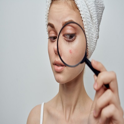 تكلفة علاج ندبات الوجه في الرياض