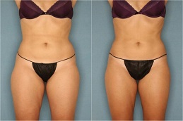 تنشيط العضلات الديناميكي (DMA) في الرياض والمملكة العربية السعودية