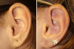 ثقب الأذن في الرياض