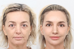 جراحة التجميل في الرياض 