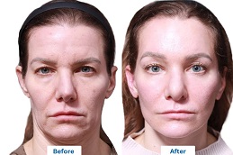 جراحة التجميل في الرياض والمملكة العربية السعودية