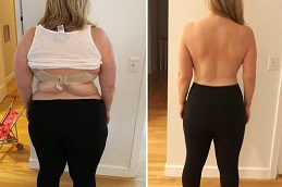 جراحة حصوات المرارة في الرياض والمملكة العربية السعودية