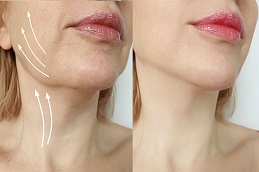 حشوات سكلبترا في الرياض والمملكة العربية السعودية