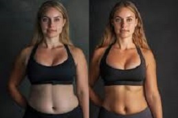 حقن ساكسيندا في الرياض