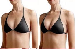 حقن فيلر الثدي في الرياض والمملكة العربية السعودية