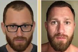 زراعة الشعر بالروبوت في الرياض والمملكة العربية السعودية