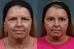 شد الجبين في الرياض