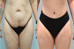 شد الجزء السفلي من الجسم في الرياض