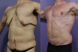 شد الجسم في الرياض، المملكة العربية السعودية