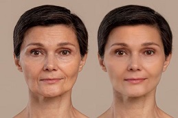 شد الوجه السحري في الرياض والمملكة العربية السعودية