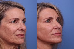 علاجات مكافحة الشيخوخة في الرياض والمملكة العربية السعودية