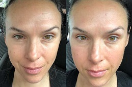 نحت الوجه في الرياض والمملكة العربية السعودية