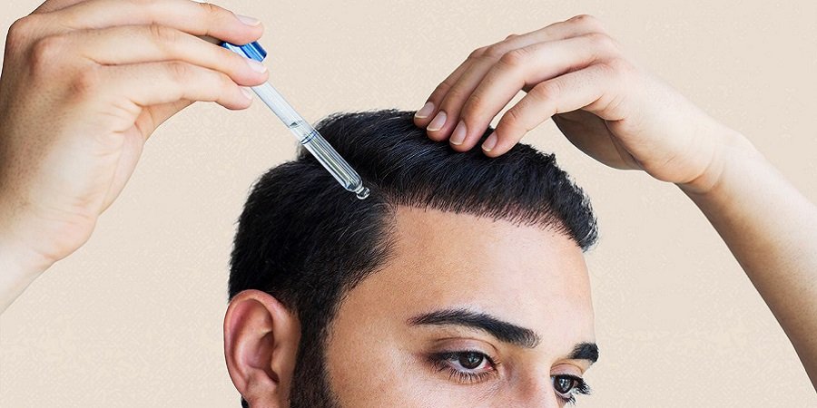 Baldness Treatment for Males in Riyadh & Saudi Arabia Cost