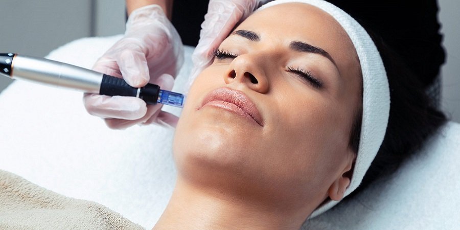 Best Micro-Needling for Acne Scars in Riyadh & Saudi Arabia