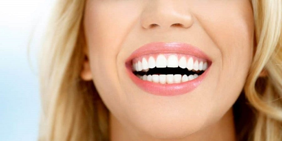 Dental Stains Removal in Riyadh & Saudi Arabia Stains Cost