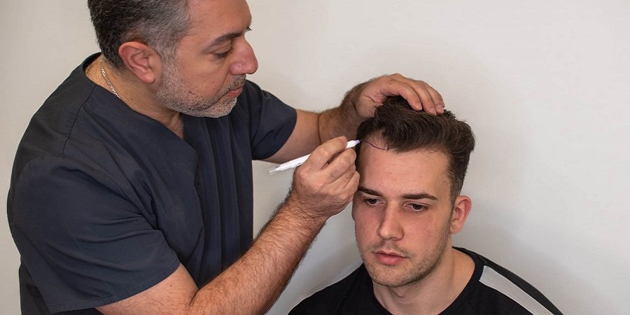 Hybrid Hair Transplant in Riyadh & Saudi Arabia Cost