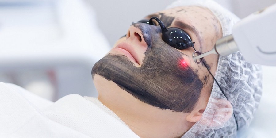 Laser Carbon Peel in Riyadh & Saudi Arabia