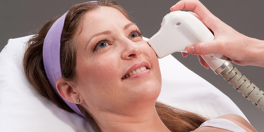 Laser Skin Tightening