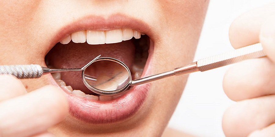 Teeth Polishing & Scaling Treatment in Riyadh & Saudi Arabia