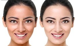 Best Skin Whitening Cost in Riyadh