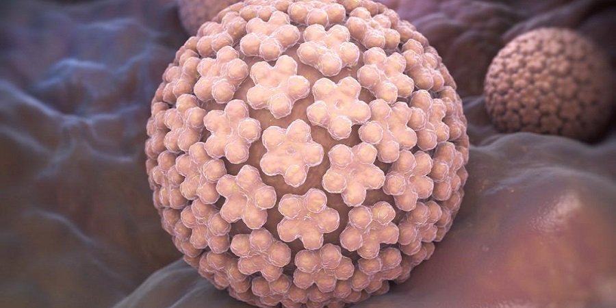 Genital Warts Removal in Riyadh & Saudi Arabia Expert Care