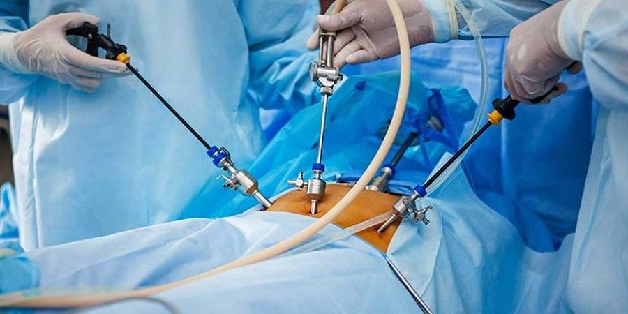 Best Laparoscopic Surgeries in Riyadh & Saudi Arabia Cost