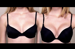 Best Breast Enlargement Injections cost in Riyadh