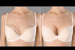 Best Breast Fillers Injections Clinic in Riyadh